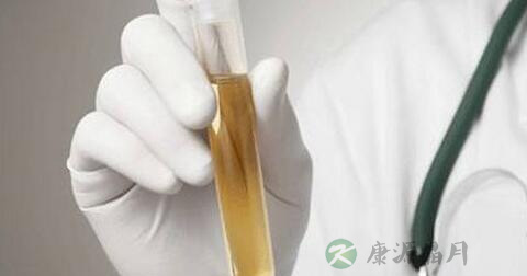 尿常规化验单怎么看