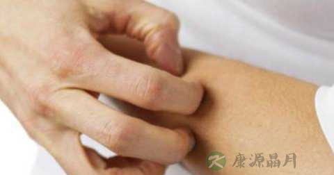 神经性皮炎的病因