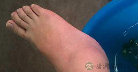 脚踝扭伤看什么科