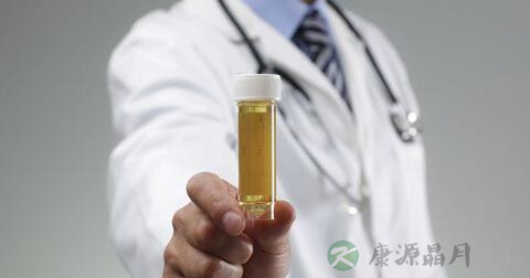 尿常规化验单怎么看