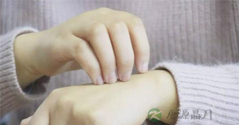 综合性干燥症怎么办