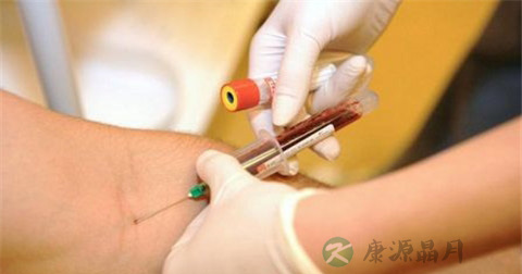 hcg血检需要空腹吗
