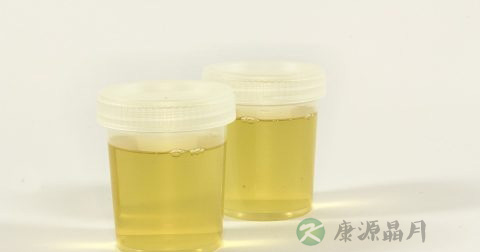 尿检蛋白质正常值