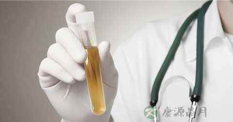怎么看孕妇尿液化验单