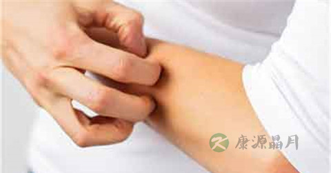 毛囊炎搽什么药膏