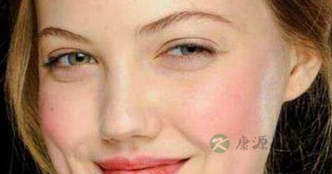 彩光治疗红血丝注意什么