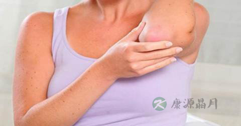 肤克达肤王软膏说明书