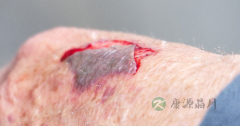 拔毒膏说明书