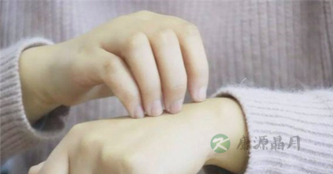 荨麻疹过敏原是什么