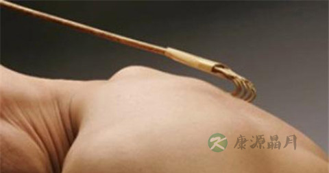 神经性皮炎吃什么水果