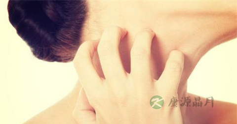 湿疹怎么治疗快