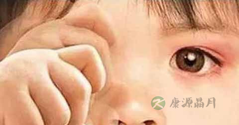 麦粒肿引起的红血丝怎么治