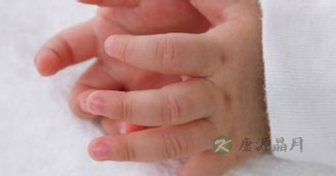 手足口病如何预防