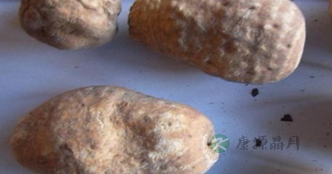 手上白癜风怎么治