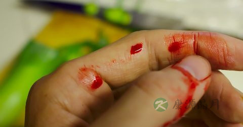 急救止血的常用方法有哪些