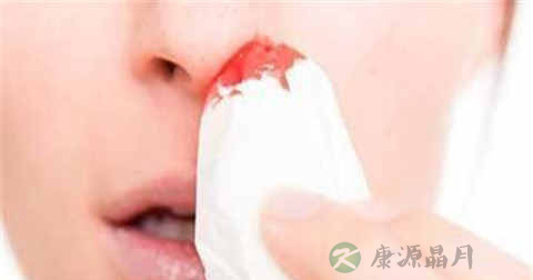 流鼻血怎么紧急处理
