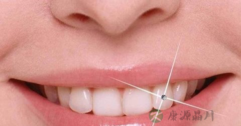 什么样的烤瓷牙好