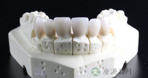 钛合金烤瓷牙的寿命