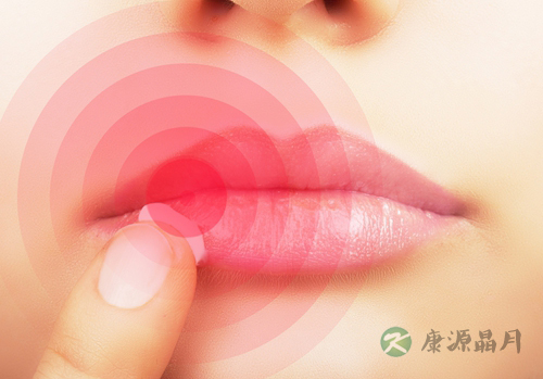 口角炎的病因及治疗 口角炎的病因及治疗