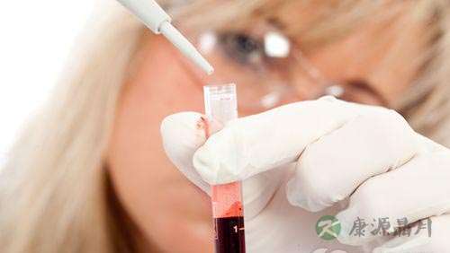 特发性血小板减少性紫癜是什么