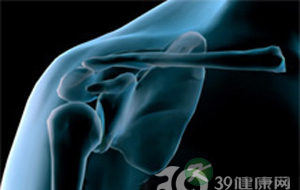“肩关节脱位”成习惯咋办？