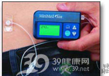 胰岛素泵　人类的第二胰腺