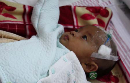 妈妈割肝救儿 8个月肝衰竭男婴获第二次生命