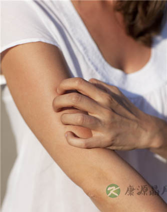 隐翅虫皮炎症状及治疗方法有哪些