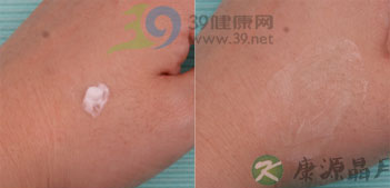 8种抗真菌药膏横向对比报告 8种抗真菌药膏横向对比报告