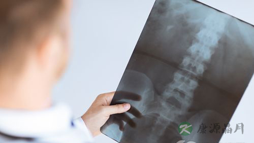 椎动脉型颈椎病的预防