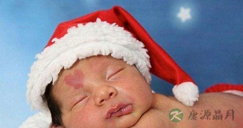 血管痣是什么原因