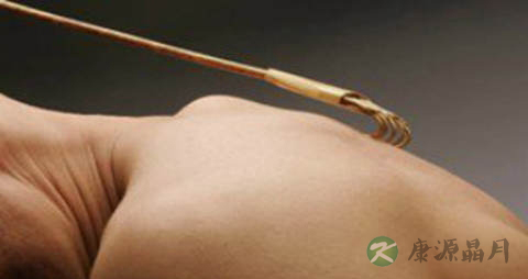 脊柱炎吃什么药