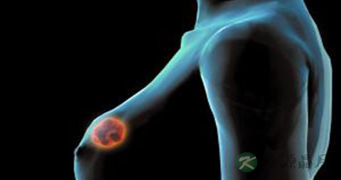 乳腺炎不能吃什么，乳腺炎的注意事项
