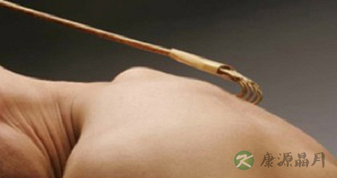 坏疽性脓皮病不能吃什么，坏疽性脓皮病的注意事项