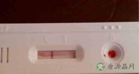 艾滋试纸具体的使用步骤介绍