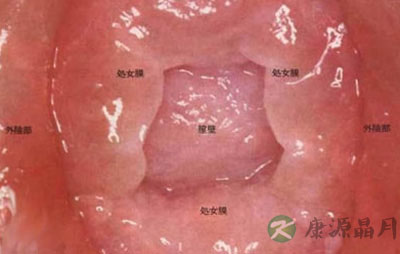 赏析 高清解读“处女膜”