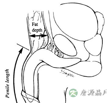 详解大小阴唇对丁丁的夹裹作用