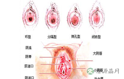 高清全图：美女处女膜的结构