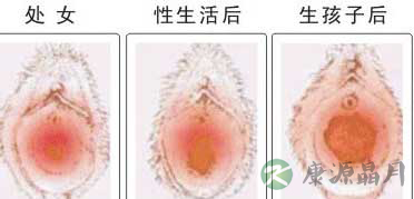 史上最震撼的女性生殖器真实图片