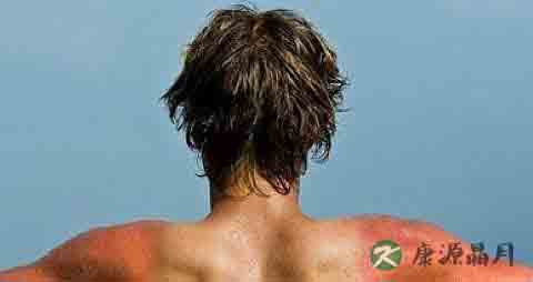 夏天皮肤晒黑怎么变白