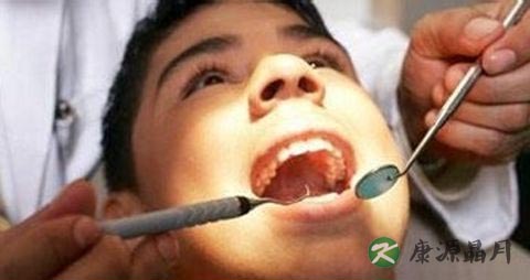 鱼刺卡到喉咙里面怎么办 鱼刺卡到喉咙里面怎么办