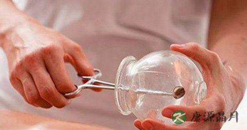 拔罐减肥有副作用吗