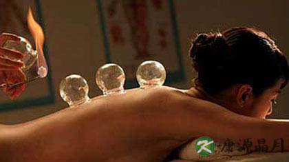 冬季养生 拔罐不宜超过15分钟