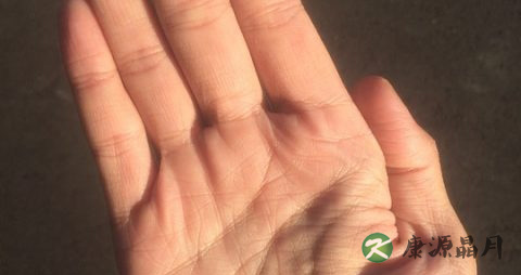 冬天手容易裂咋办 冬天手容易裂咋办