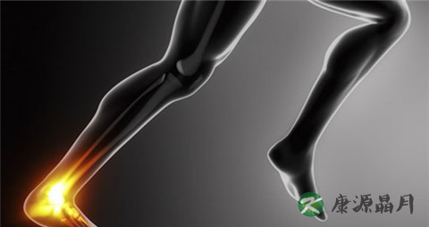 如何治疗静脉曲张