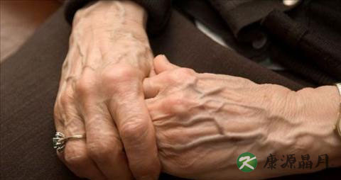 冬天手冻烂了用什么药