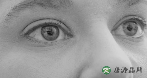 红鼻子怎么办 红鼻子怎么办