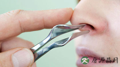 鼻咽癌能治好吗