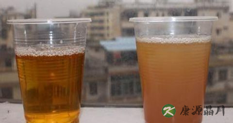 尿液发黄是怎么回事