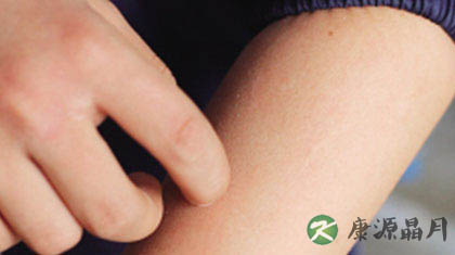 皮肤瘙痒起红疙瘩是怎么回事